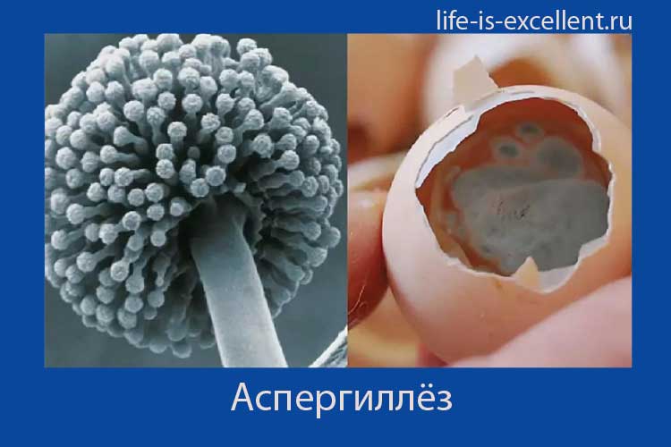 аспергиллёз, что такое аспергиллёз, возбудитель аспергиллёза, как заражаются аспергиллёзом, аспергилл, микоз лёгких