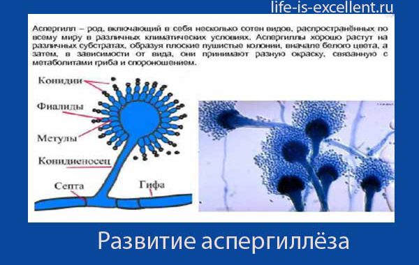 Аспергиллёз, факторы риска